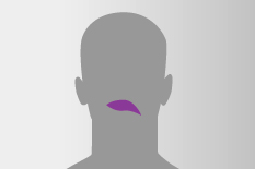 Einseitig hängender Mundwinkel schematisch dargestellt: der Mund ist lila gefärbt, und der Mundwinkel der grauen Kopfsilhouette ist an einer Seite nach unten gezogen.