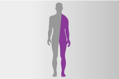 Halbseitenlähmung schematisch dargestellt: eine Seite der grauen Menschensilhouette ist lila gefärbt.