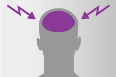 In einer grauen Kopfsilhouette ist das Gehirn lila markiert, neben dem Kopf sind beidseitig lila Blitze zu sehen