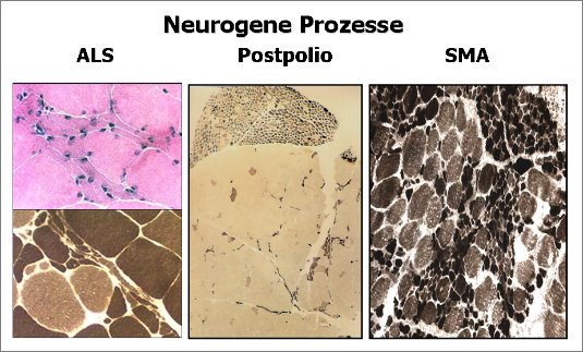 Neurogene Prozesse